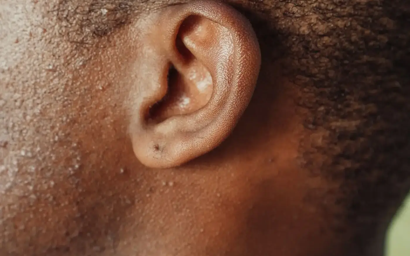 Close-up of ear illustrating tinnitus and ringing in ears